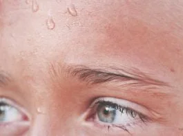effective-measures-against-abundant-sweating